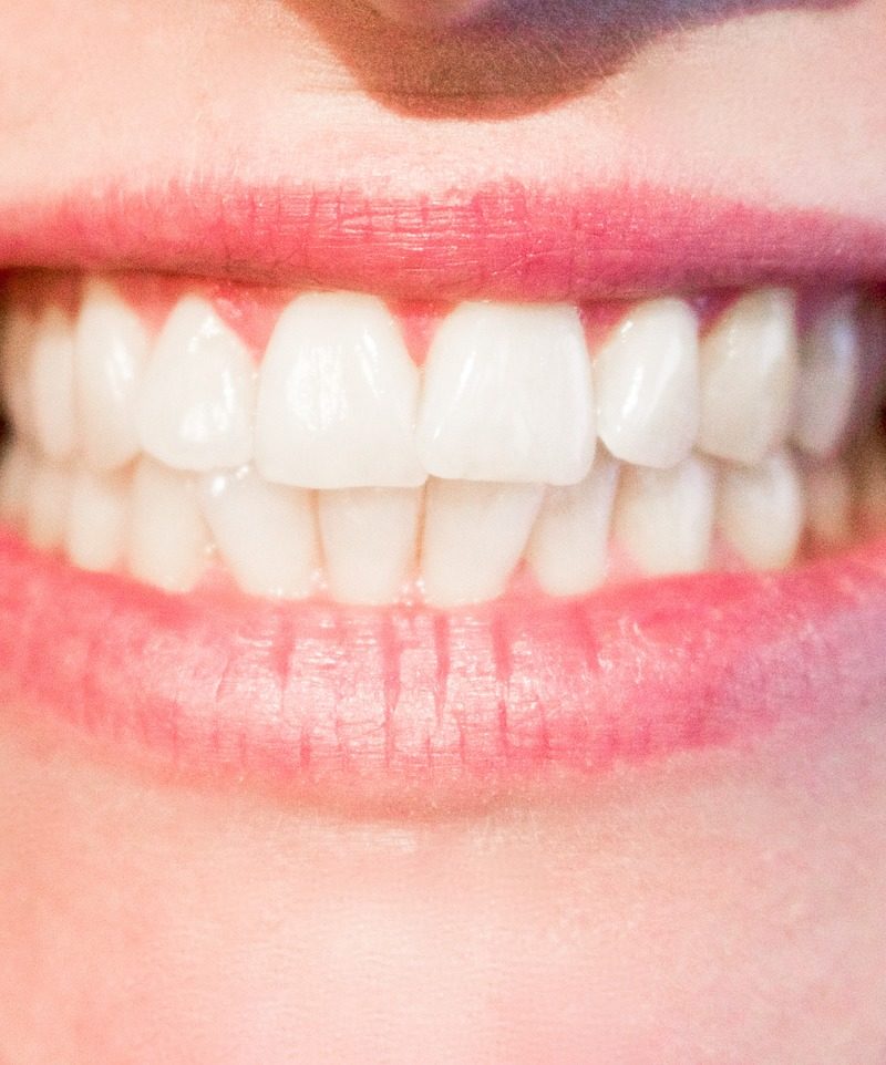 Dzisiejsza technika stosowana w salonach stomatologii estetycznej zdoła spowodować, że odbierzemy śliczny uśmiech.